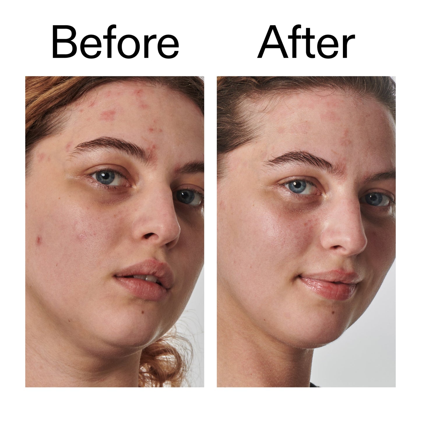 10-urea-moisturizer-y8 Dry_and_Rough_Skin_Solution_Before_After_2000x2000_efa6e639-5c39-49bd-a5dd-f0220293120a.jpg