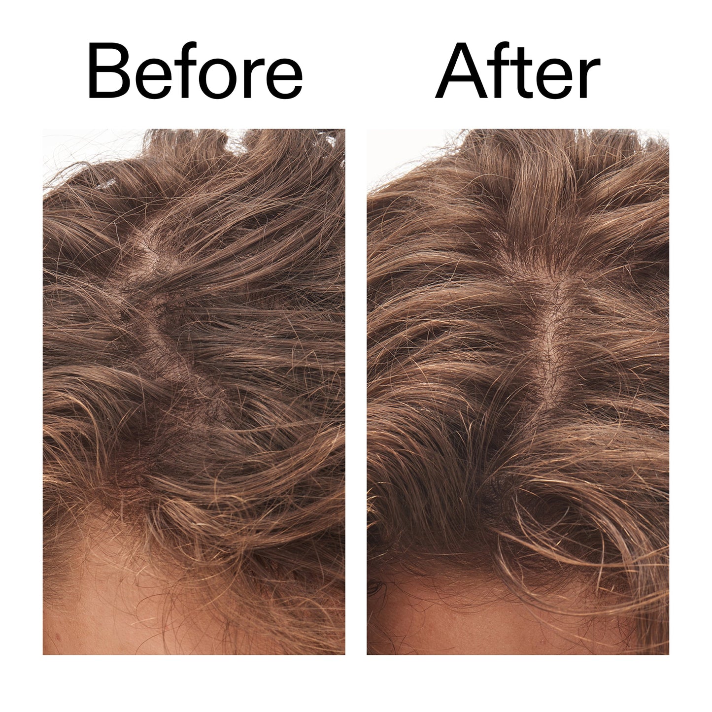 glycolic-acid-exfoliating-scalp-scrub-s5 Glycolic_Acid_Exfoliating_Scalp_Scrub_Before_After_2000x2000_b8561c87-05a1-4caa-80f7-1b6b33d750f7.jpg