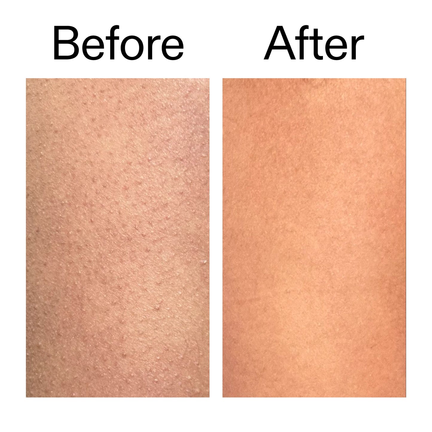 glycolic-acid-exfoliating-body-stick-c3 Glycolic_Body_Stick_B_A_2000x2000_6e6e6b4d-5bd7-43c0-aeed-4d66788e8995.jpg