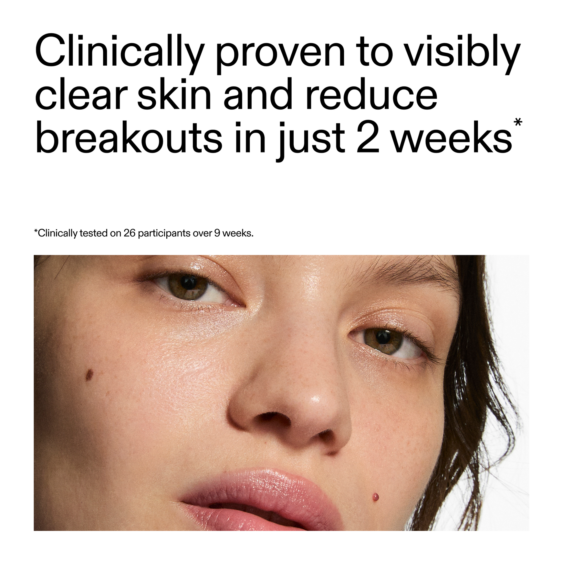 360-acne-clearing-serum-u6 360_Serum_Key_Claim.png