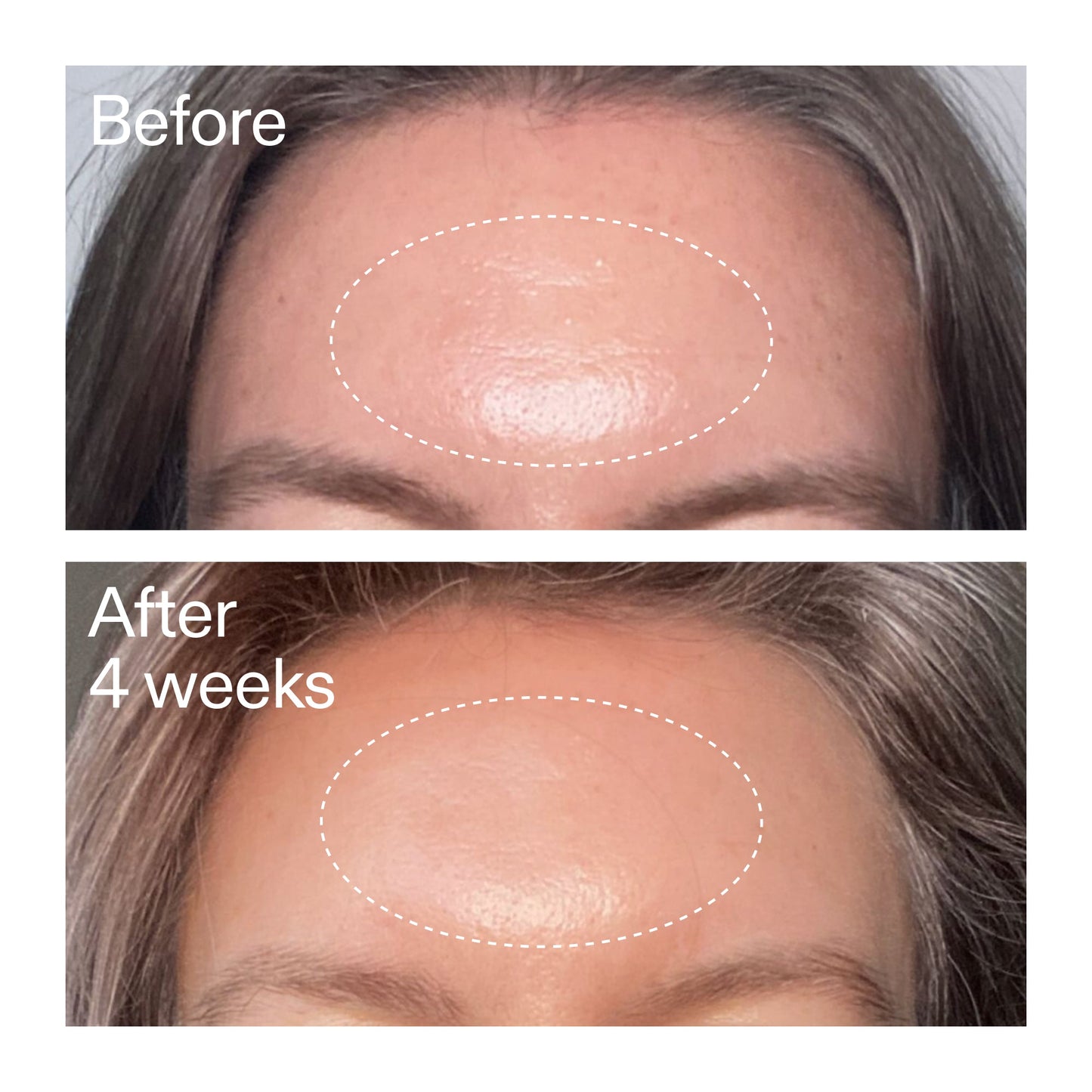 advanced-0-2-retinal-serum-n2 AdvancedRetinal_BeforeAfter1_2000x2000_1da6bb0a-29dd-41d1-95b7-8679696bbf0f.jpg