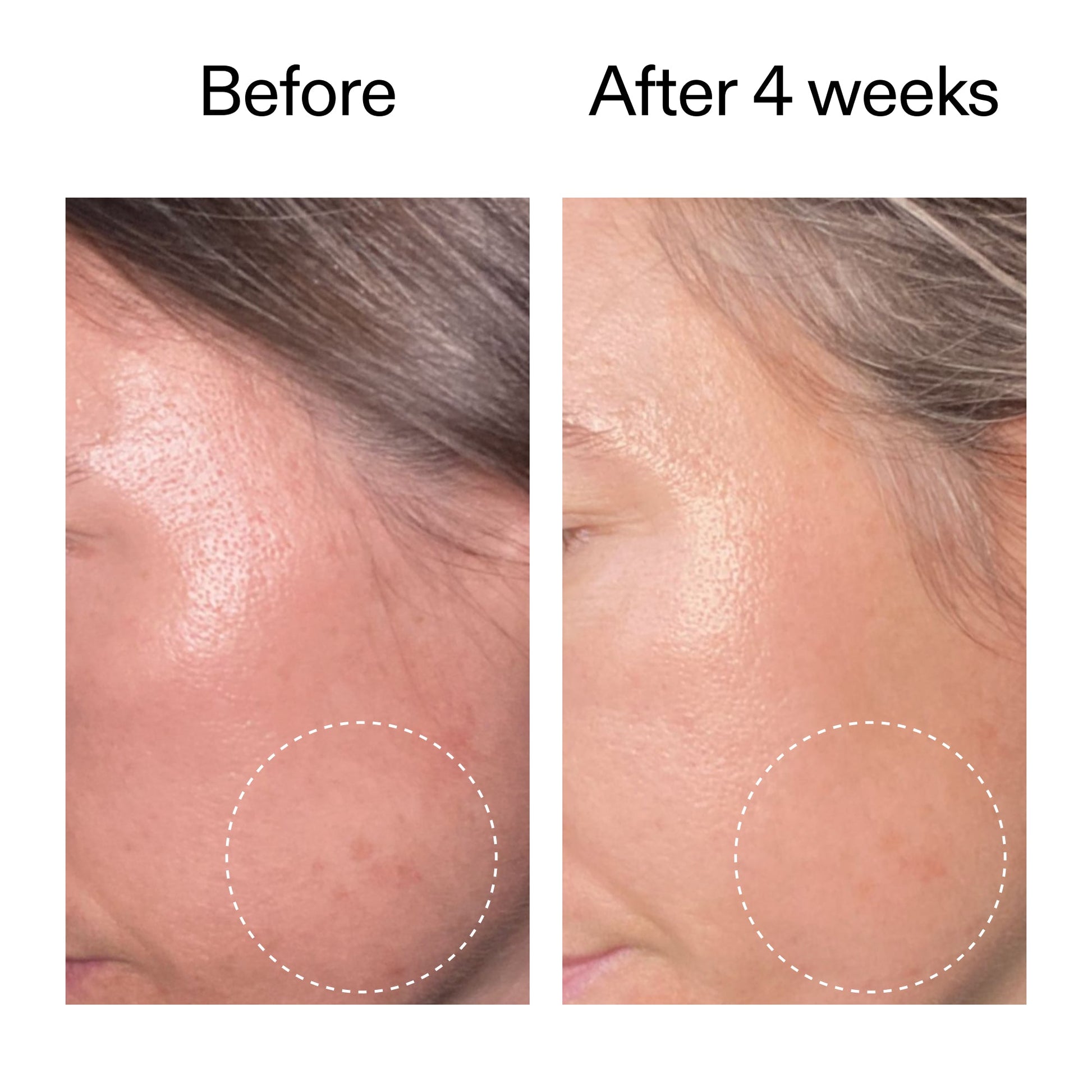 advanced-0-2-retinal-serum-duo-t3 AdvancedRetinal_BeforeAfter2__2000x2000_8ef75542-2316-4814-81ee-0f66a85912bc.jpg