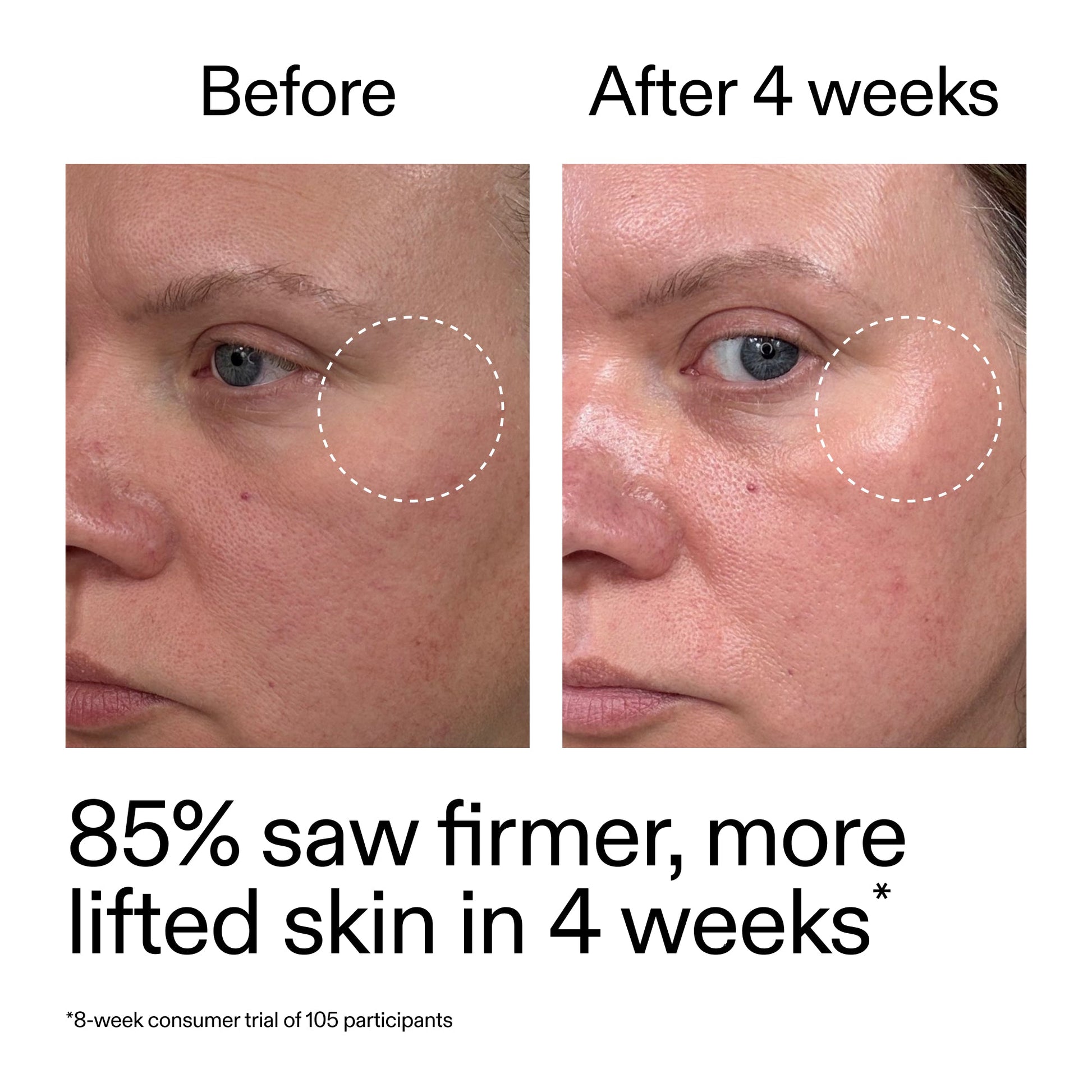 advanced-0-2-retinal-serum-duo-t3 AdvancedRetinal_BeforeAfter_Claim1_2000x2000_3a315aa8-f408-4b33-bbeb-0d9209f98404.jpg