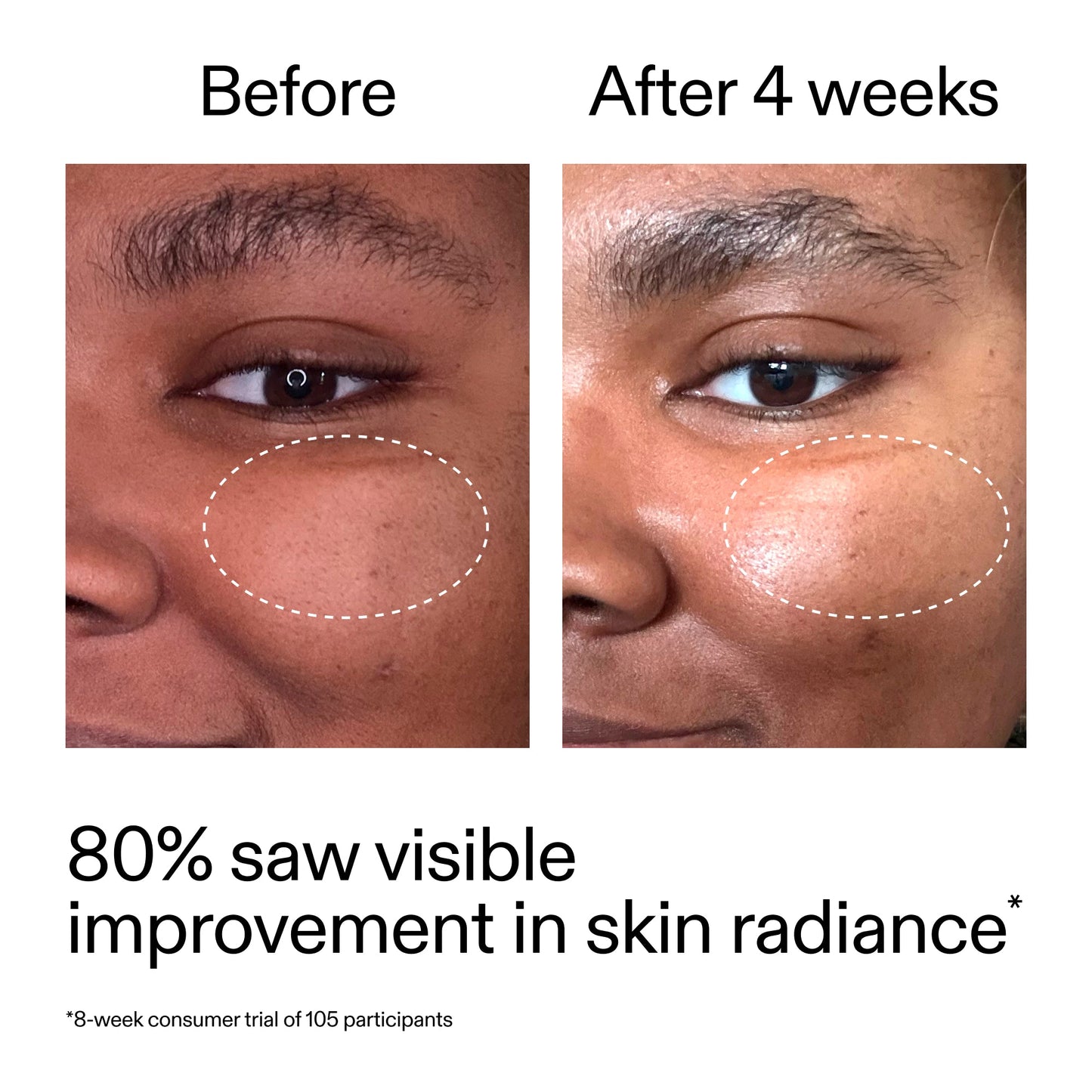 advanced-0-2-retinal-serum-n2 AdvancedRetinal_BeforeAfter_Claim2_2000x2000_39d11e3d-eda9-44ec-ab32-2903b1a368bd.jpg