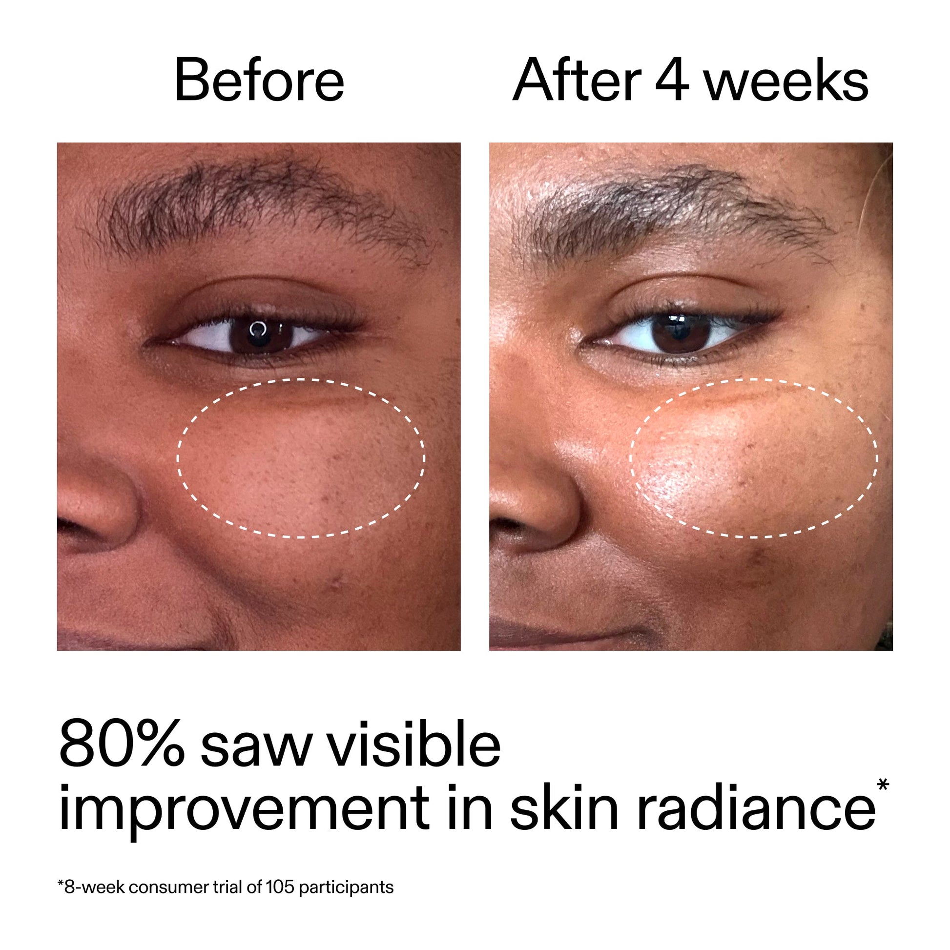 advanced-0-2-retinal-serum-n2 AdvancedRetinal_BeforeAfter_Claim2_2000x2000_39d11e3d-eda9-44ec-ab32-2903b1a368bd.jpg