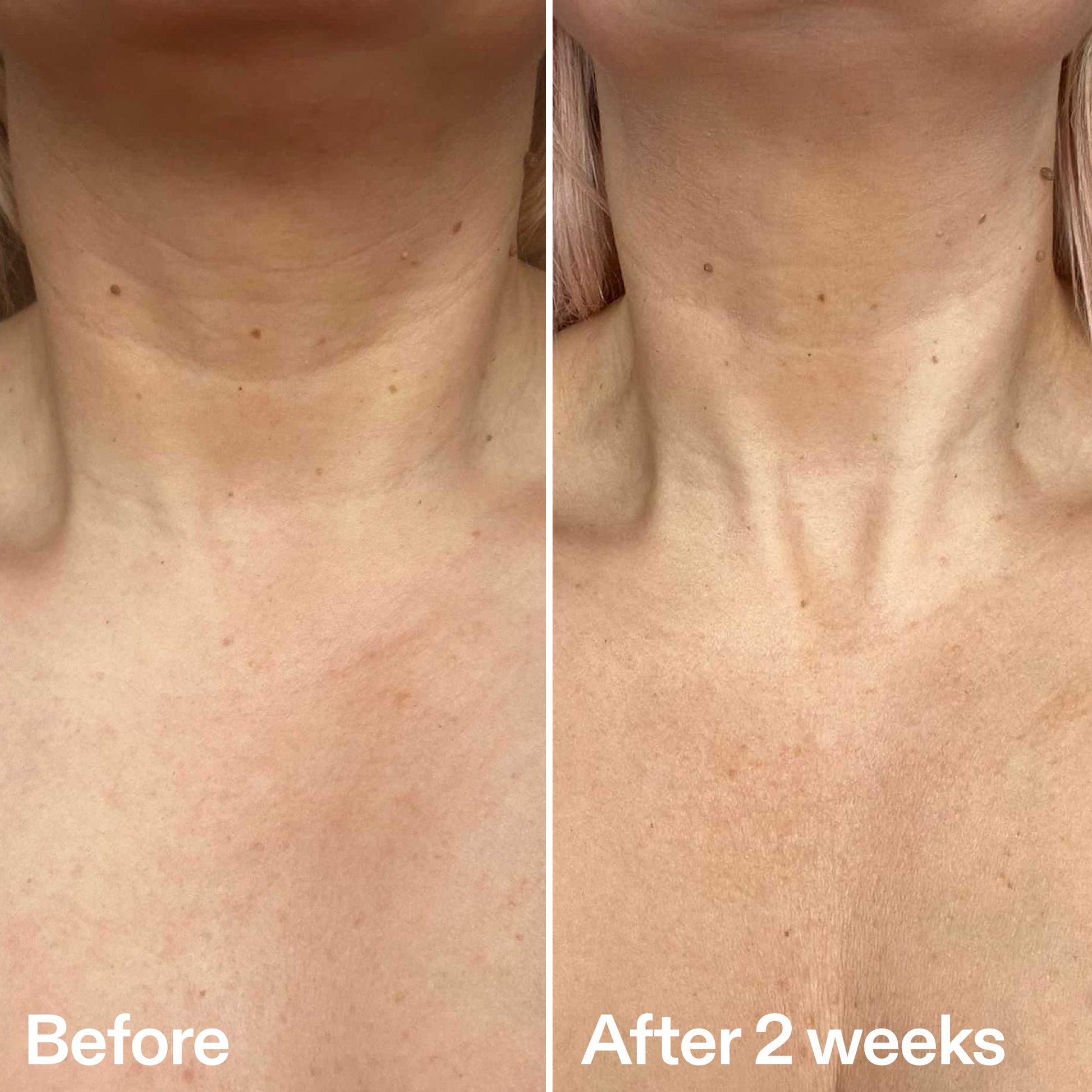 bio-active-neck-lift-stick-a8 B_A_2.jpg