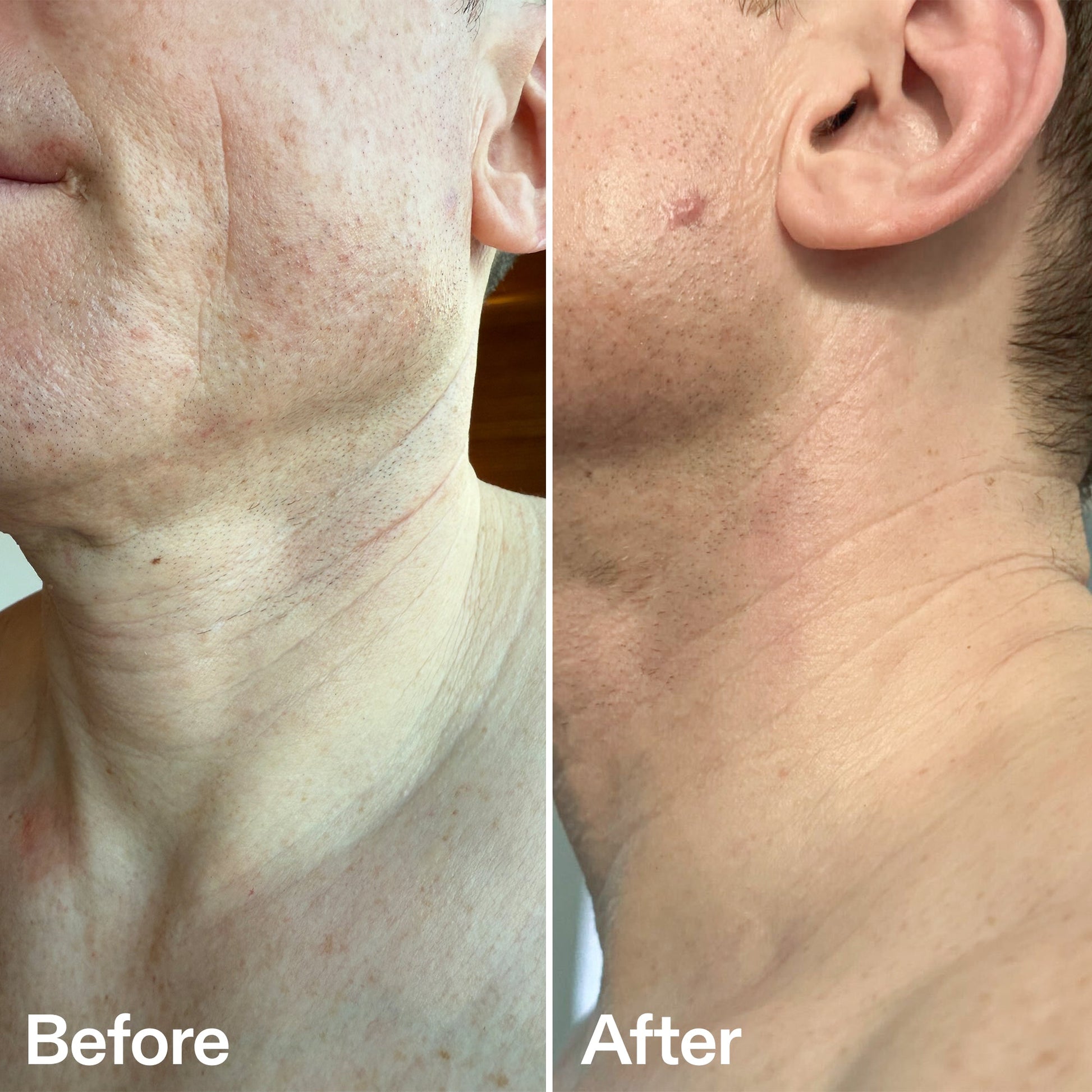 bio-active-neck-lift-stick-a8 B_A_afa2743e-b8e2-4504-92f4-e281cb6cf759.jpg