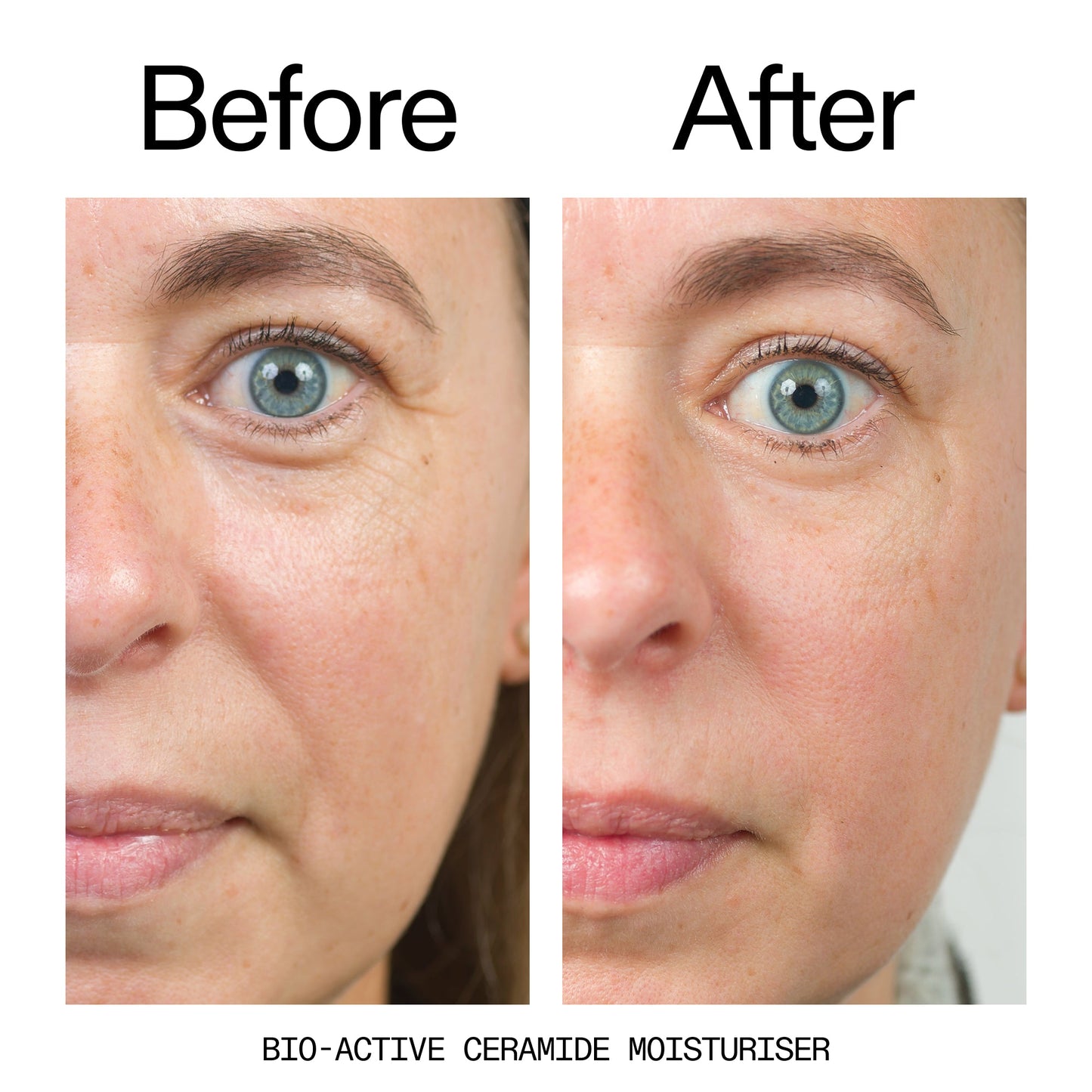 barrier-boosting-trio-c0 Bio-Active_Before_After_2000x2000_600947b4-e8c5-425a-9155-fc15bc83aa12.jpg