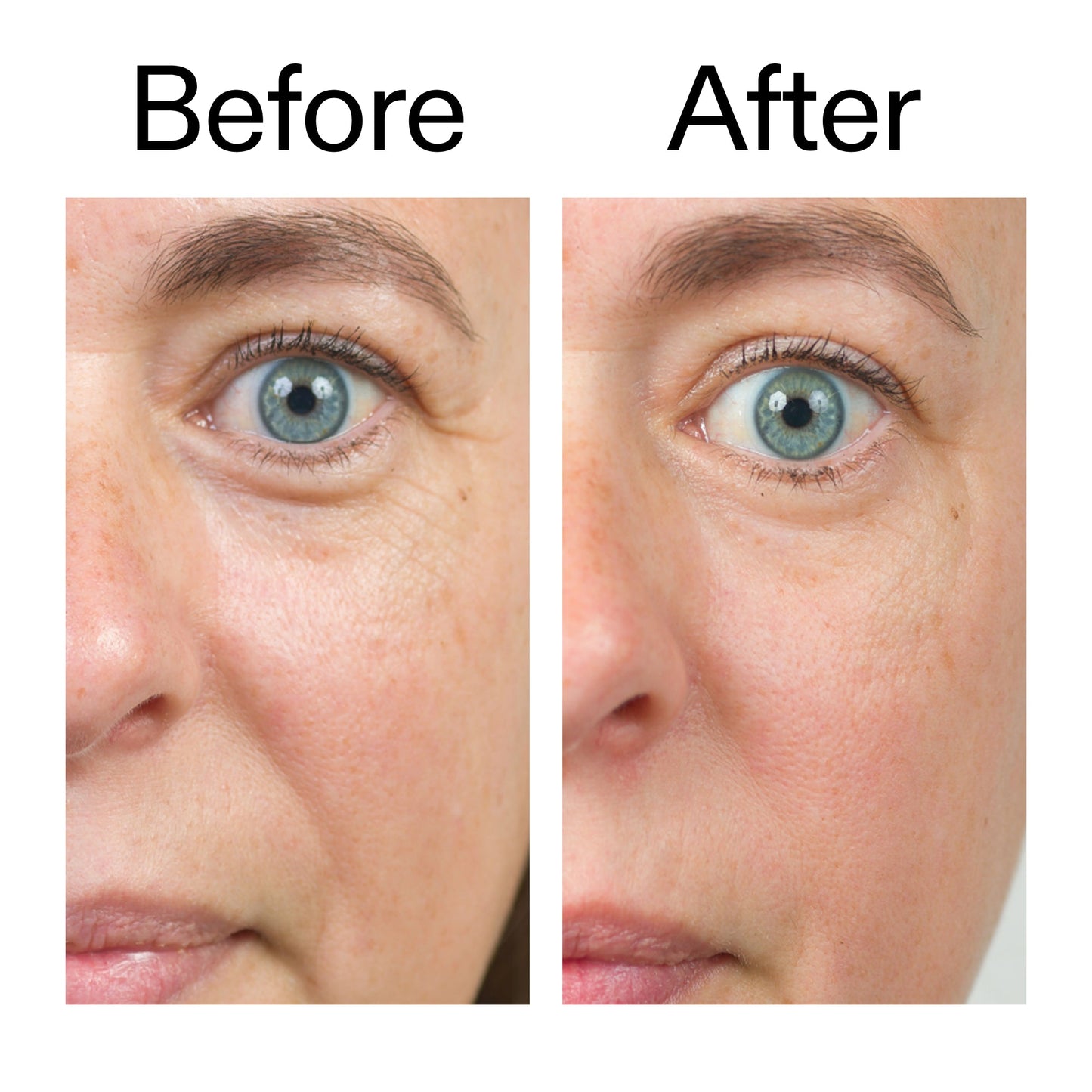 bio-active-ceramide-moisturizer-s0 Bio-Active_Before_After_2000x2000_566e5a9e-135e-417a-8242-b44e5fa35463.jpg