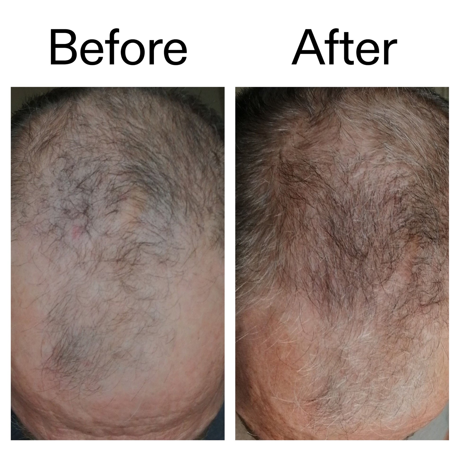 caffeine-stimulating-scalp-treatment-k1 Caffeine_Scalp_Treatment_B_A_Ppage_2000_x_2000.jpg