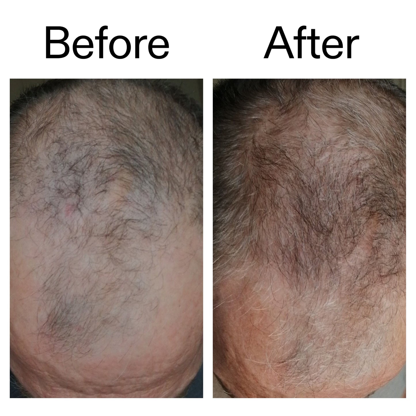 3-month-hair-growth-trio-y0 Caffeine_Scalp_Treatment_B_A_Ppage_2000_x_2000.jpg