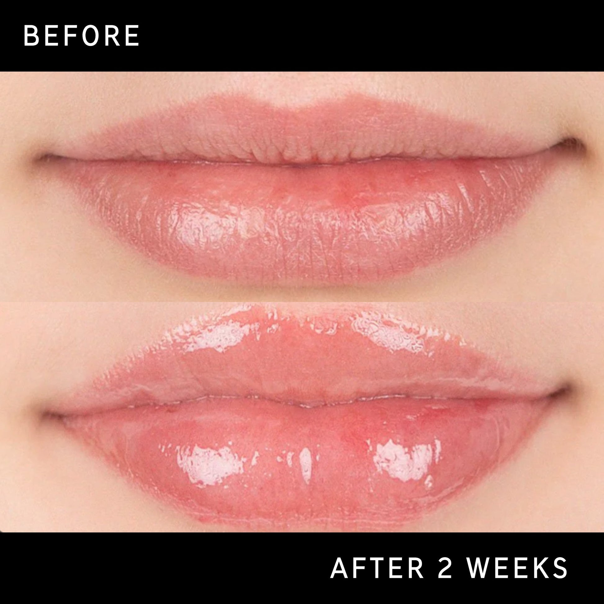 lip-plumping-duo-i2 DTC-Top15_Amends_Tripeptide-Lip_B_A.jpg