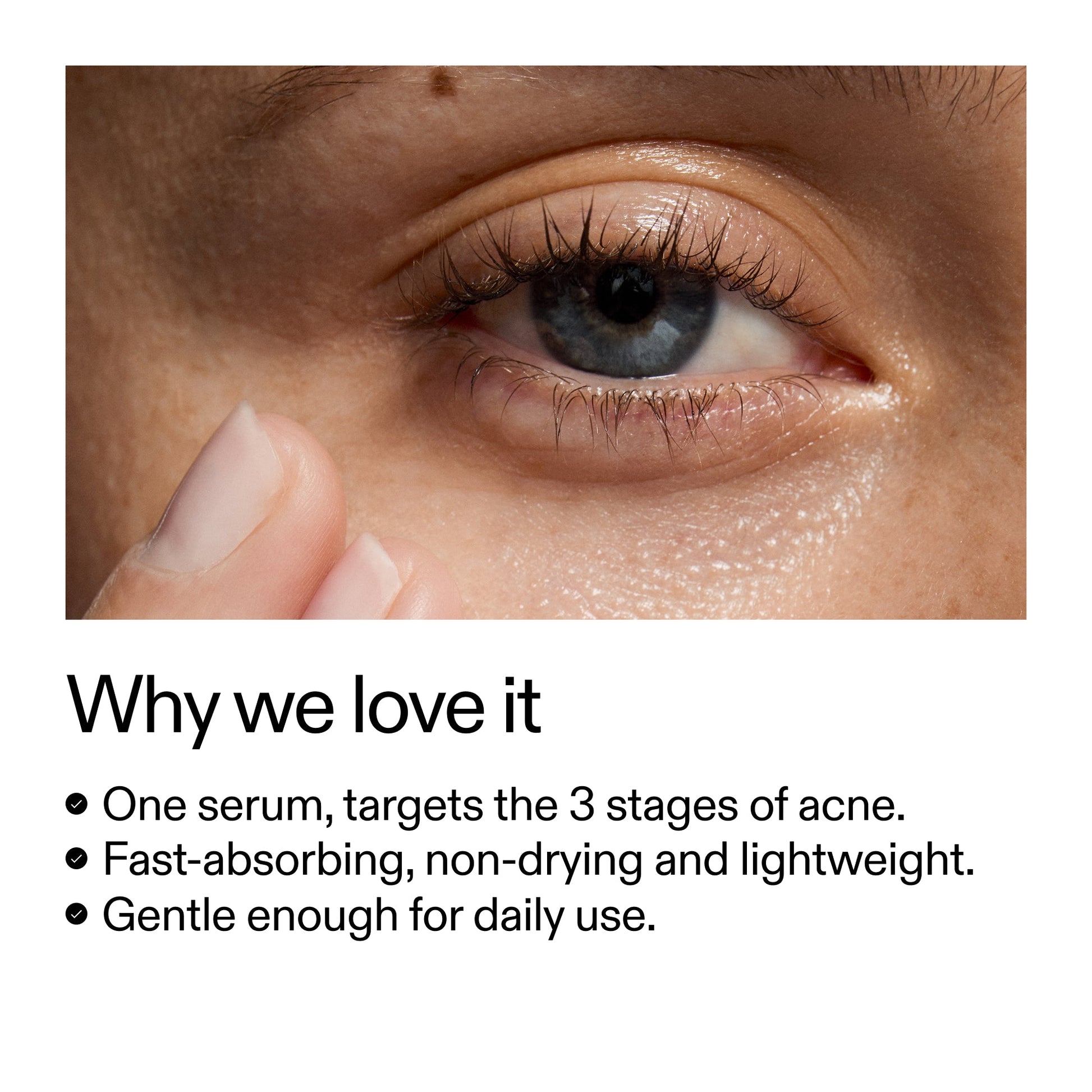 360-acne-clearing-serum-u6 Dioic_Whyweloveit_2000x2000_175aafd3-0cbe-403a-b317-a8362881bfe2.jpg