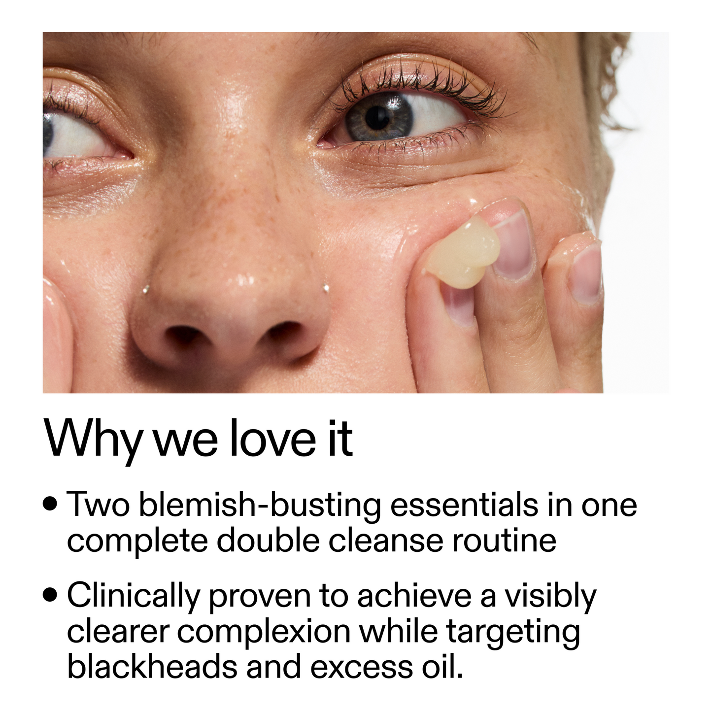 acne-double-cleanse-duo-r4 Double_Cleanse_Duo_for_Breakouts_Why_We_2000x2000_f242cb12-bb5c-487c-b203-071ccb406ec5.png