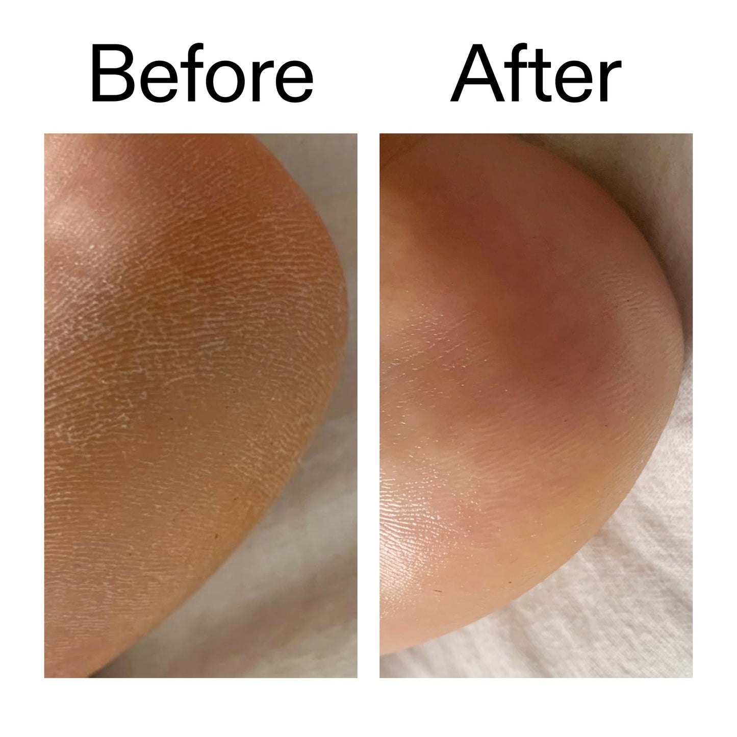 glycolic-acid-exfoliating-body-stick-c3 Glycolic_Acid_Exfoliating_Body_Stick_Before_After_V1_2000x2000_a3043625-9400-429a-a7fb-d6dbd220f722.jpg