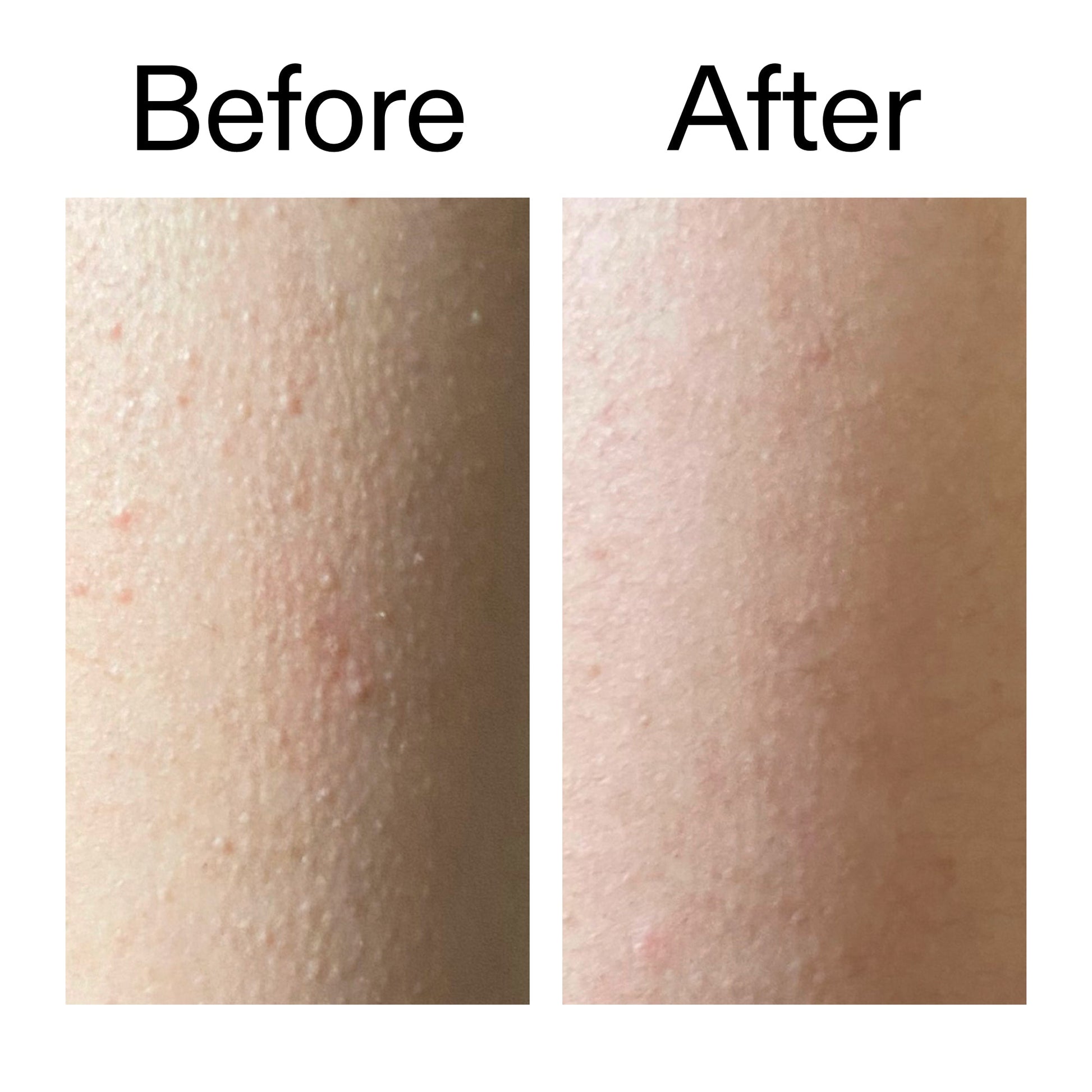 glycolic-acid-exfoliating-body-stick-c3 Glycolic_Acid_Exfoliating_Body_Stick_Before_After_V2_2000x2000_2e4ba052-94f6-4d56-82df-7bdb5b2df7ae.jpg