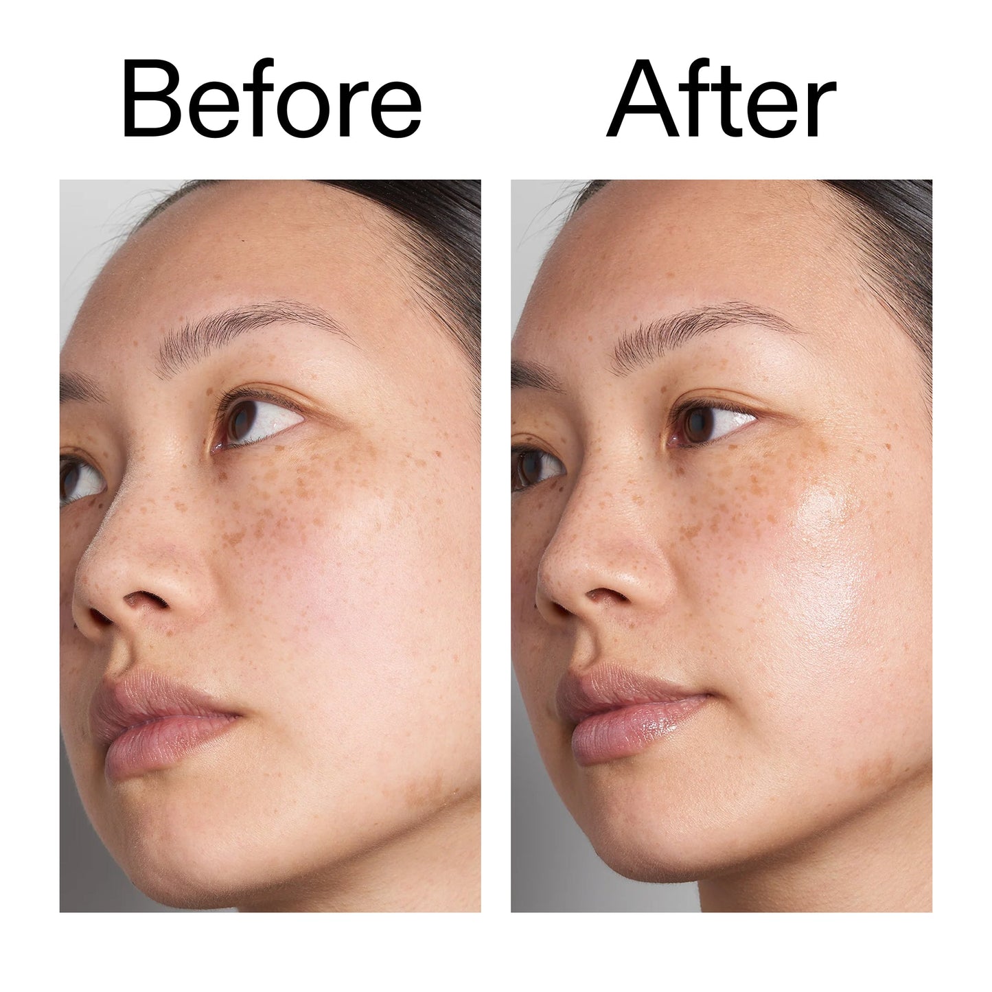 hyaluronic-acid-serum-60ml-duo-j8 Hyaluronic_Acid_Before_After_2000x2000_d566f5ba-a77e-4585-99fd-0f4682b164dd.jpg
