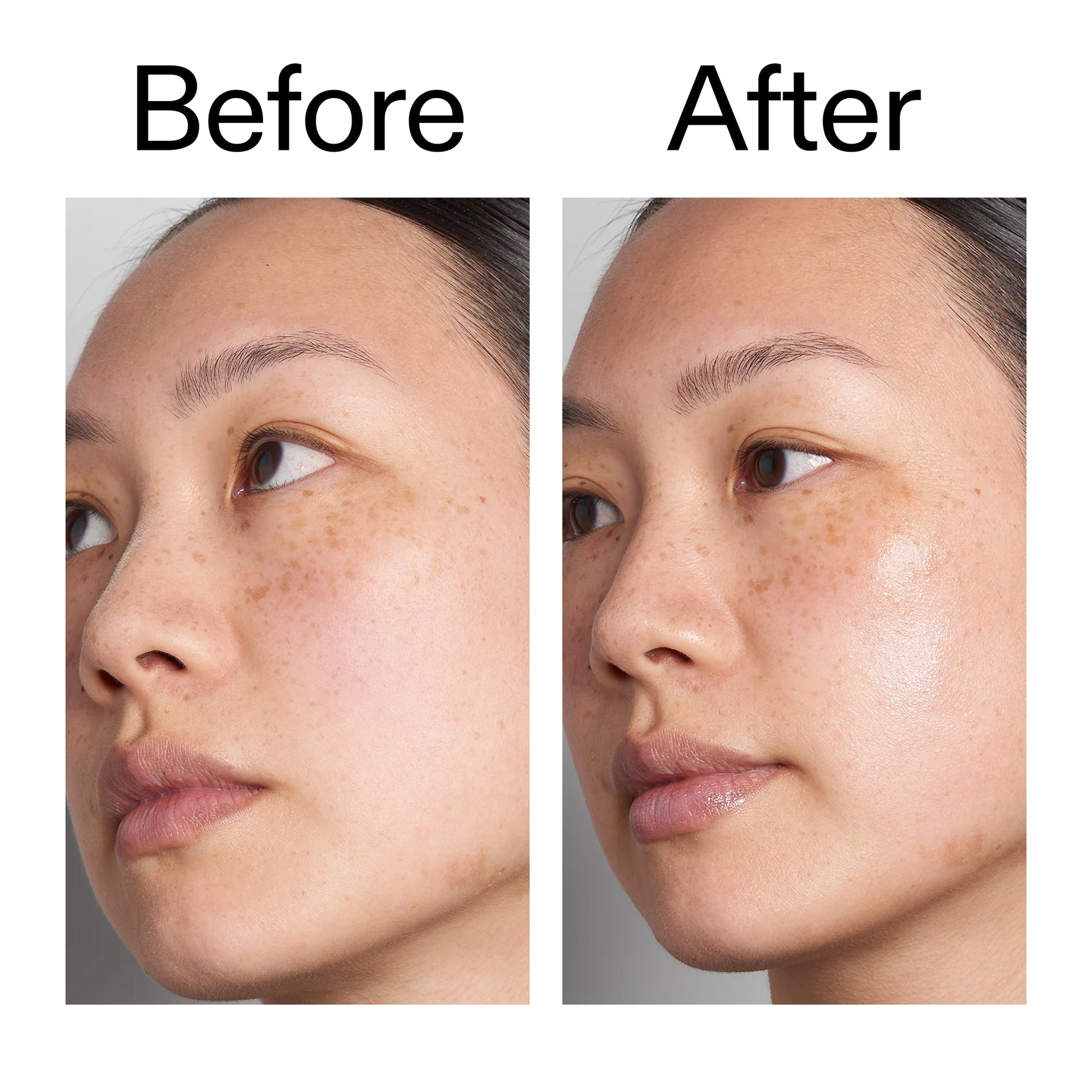 supersize-hyaluronic-acid-serum-100ml-duo-r6 Hyaluronic_Acid_Before_After_2000x2000_d7983956-8aa2-4ea3-8255-c63e8d4f892e.jpg