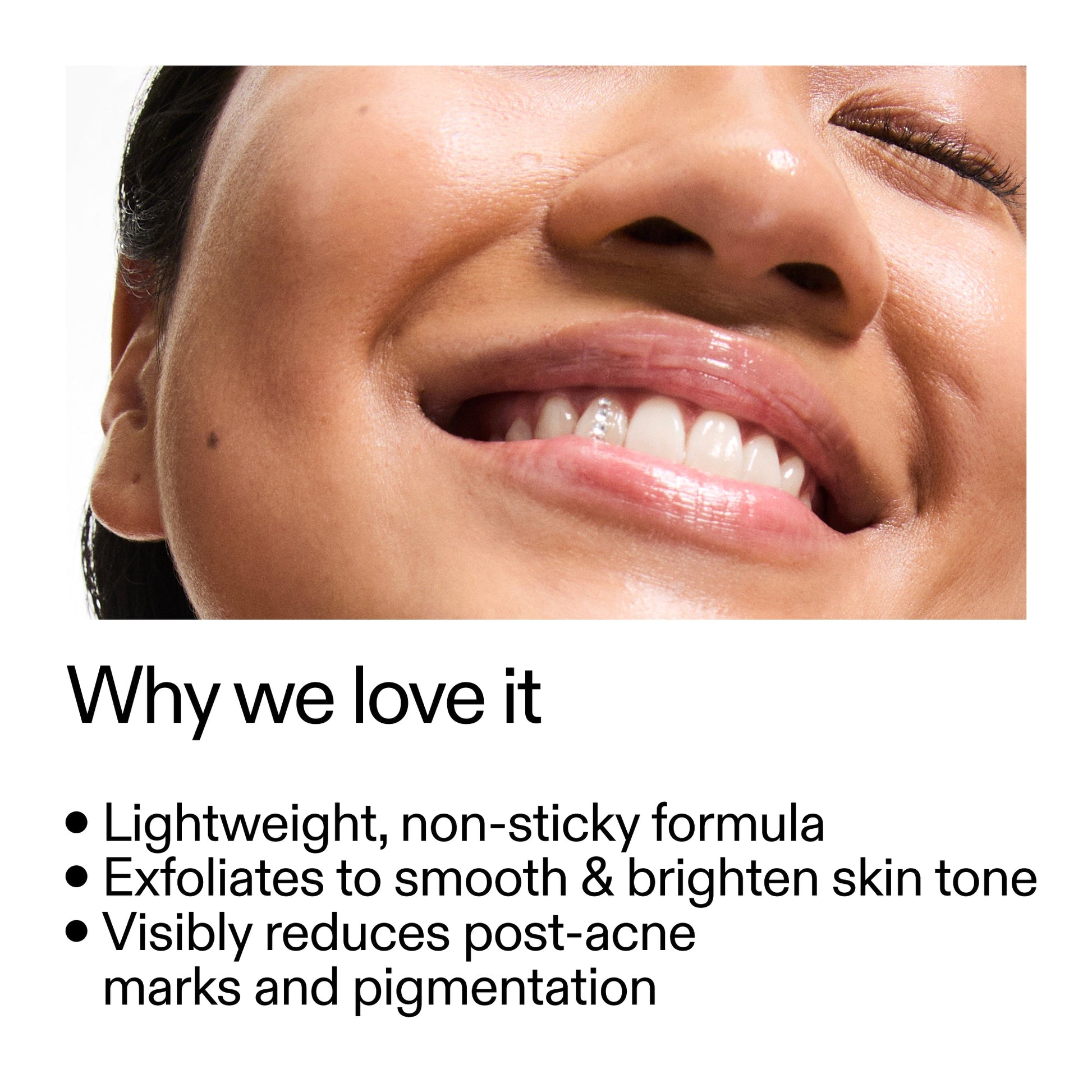mandelic-acid-treatment-t2 Mandelic_Acid_Treatment_Why_we_love_it_2000x2000_6dfe29a9-2a79-464f-a5e8-e5ac37d93388.jpg