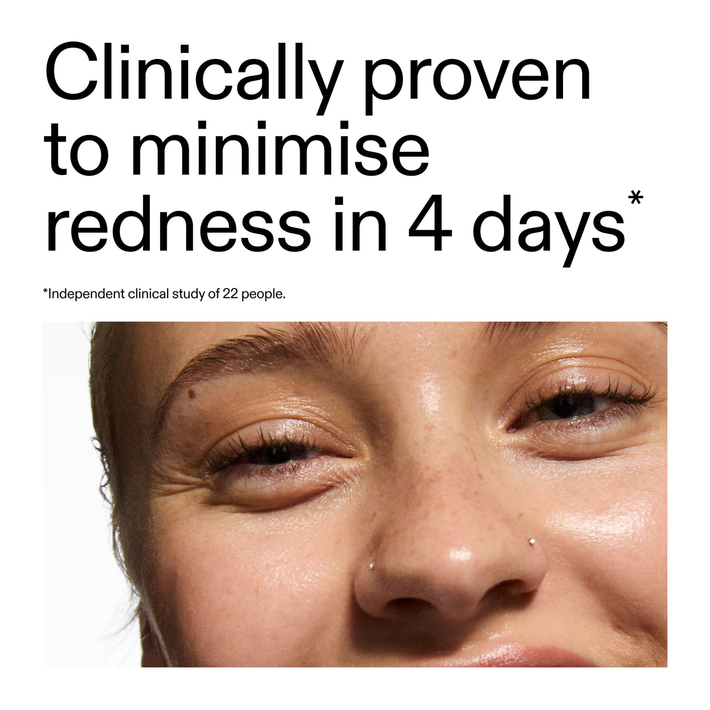 10-azelaic-acid-serum-for-redness-relief-m2 Oat_Cleansing_Balm_Claim_2000x2000_52a841dc-353c-4f2c-8646-3aadb604507d.jpg