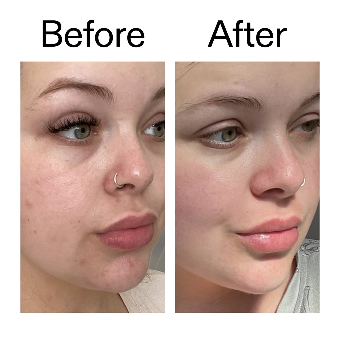 supersize-omega-water-cream-100ml-q9 Omega50_Before_After_2000x2000_46483ed8-3f9d-487f-9a0c-9df79830bd65.jpg