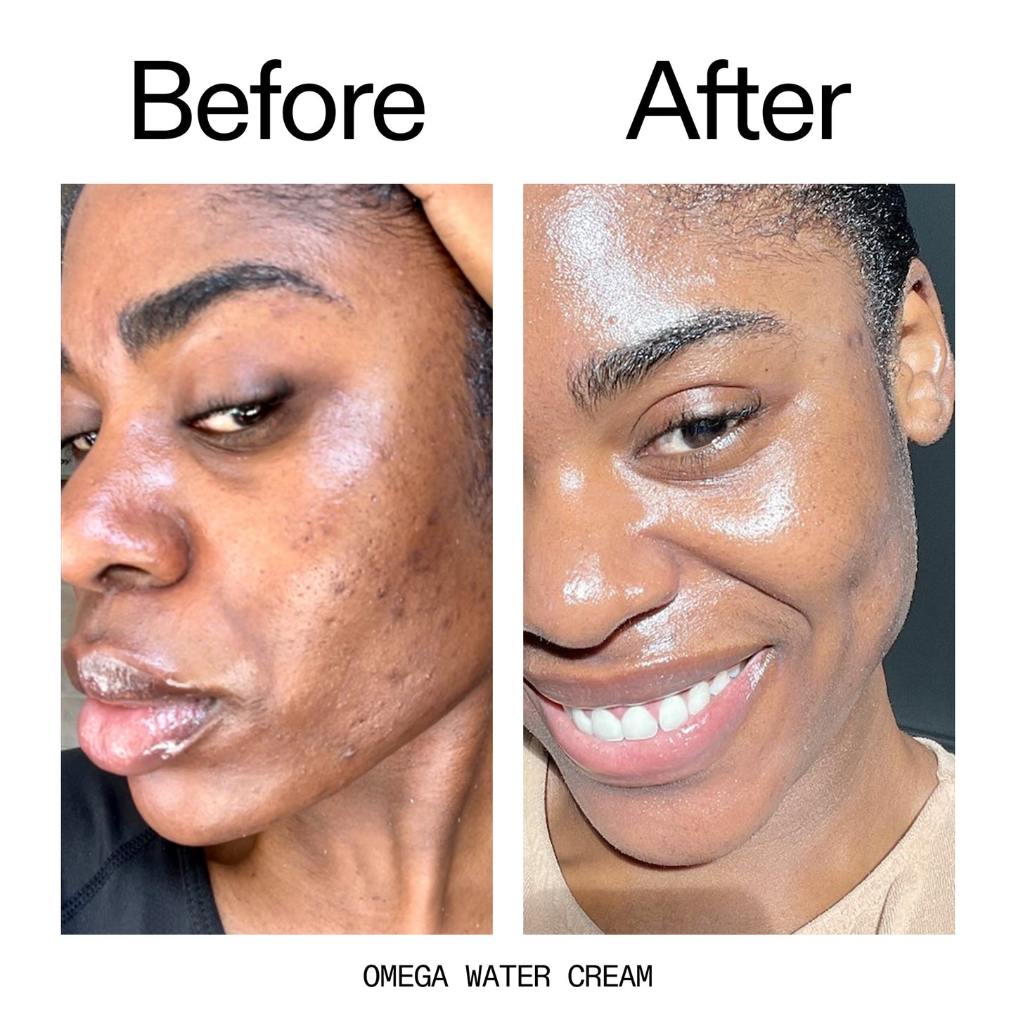 glowing-skin-set-a1 Omega_Water_Cream_Before_After_2000x2000_8e88278b-8c8d-48dc-ac77-4e98ebbd1b77.jpg