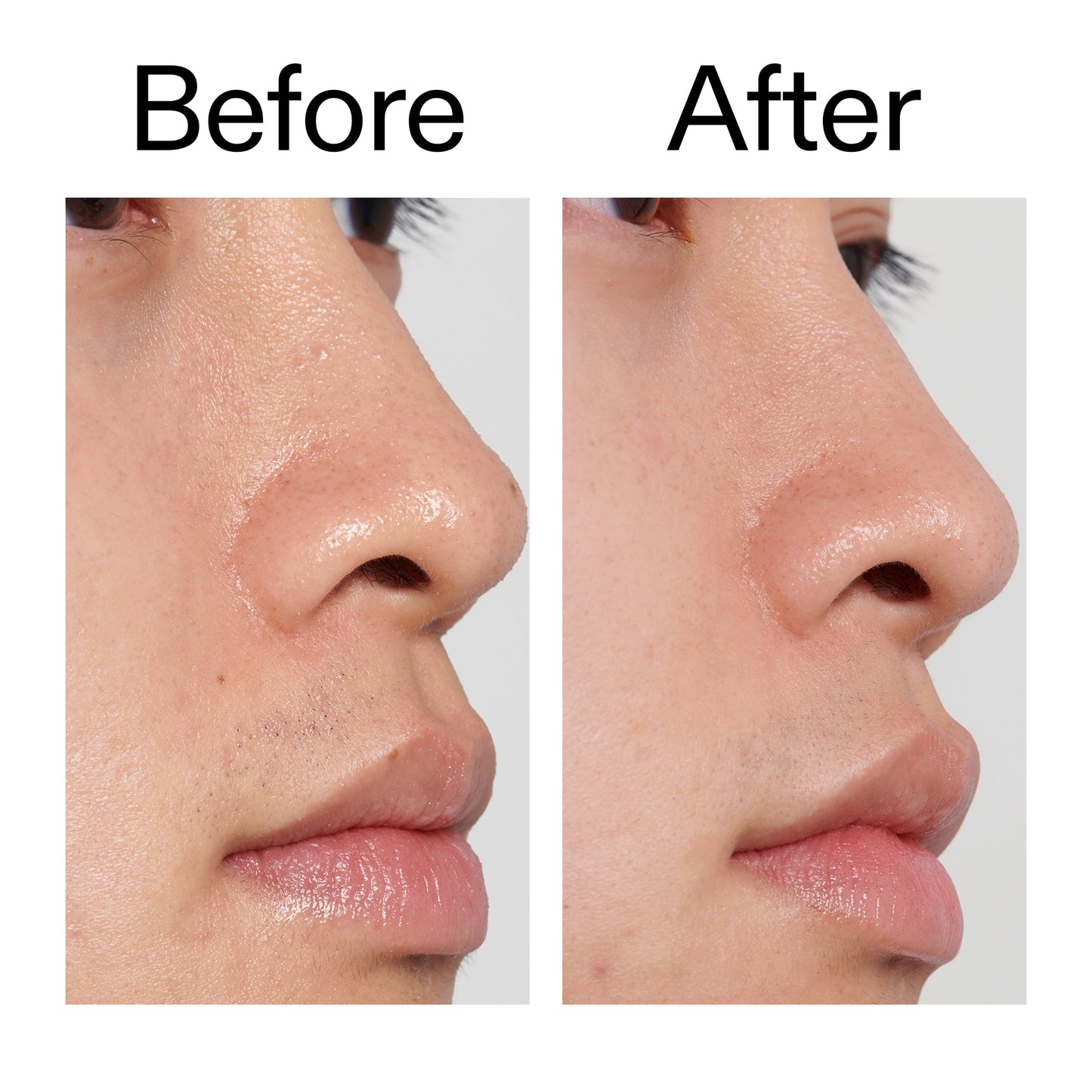 pha-toner-a0 PHA_Toner_Before_After_2000x2000_e3c10172-0150-4342-8b95-57417eaff50d.jpg