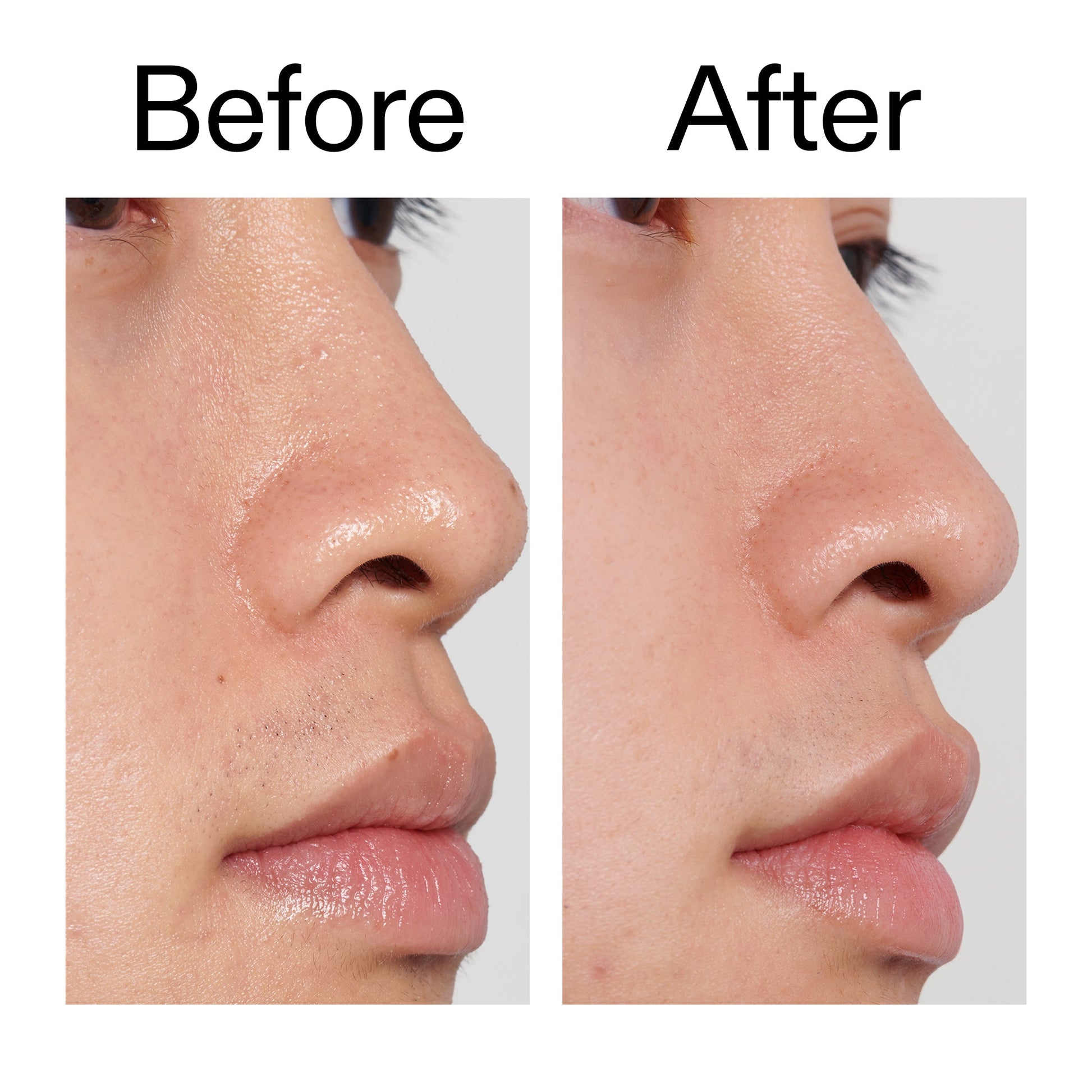 pha-toner-a0 PHA_Toner_Before_After_2000x2000_e3c10172-0150-4342-8b95-57417eaff50d.jpg