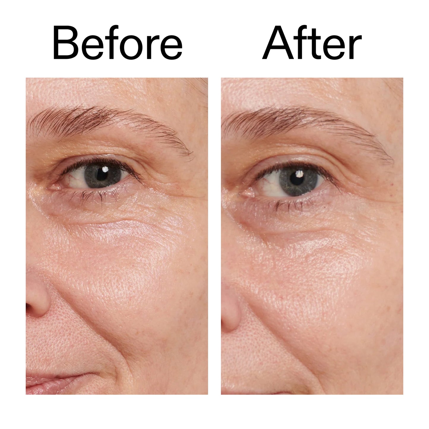 retinol-eye-cream-i7 Retinol_Eye_Cream_Before_After_2000x2000_ac03a80c-109e-4572-a95a-91dc109b4d27.jpg