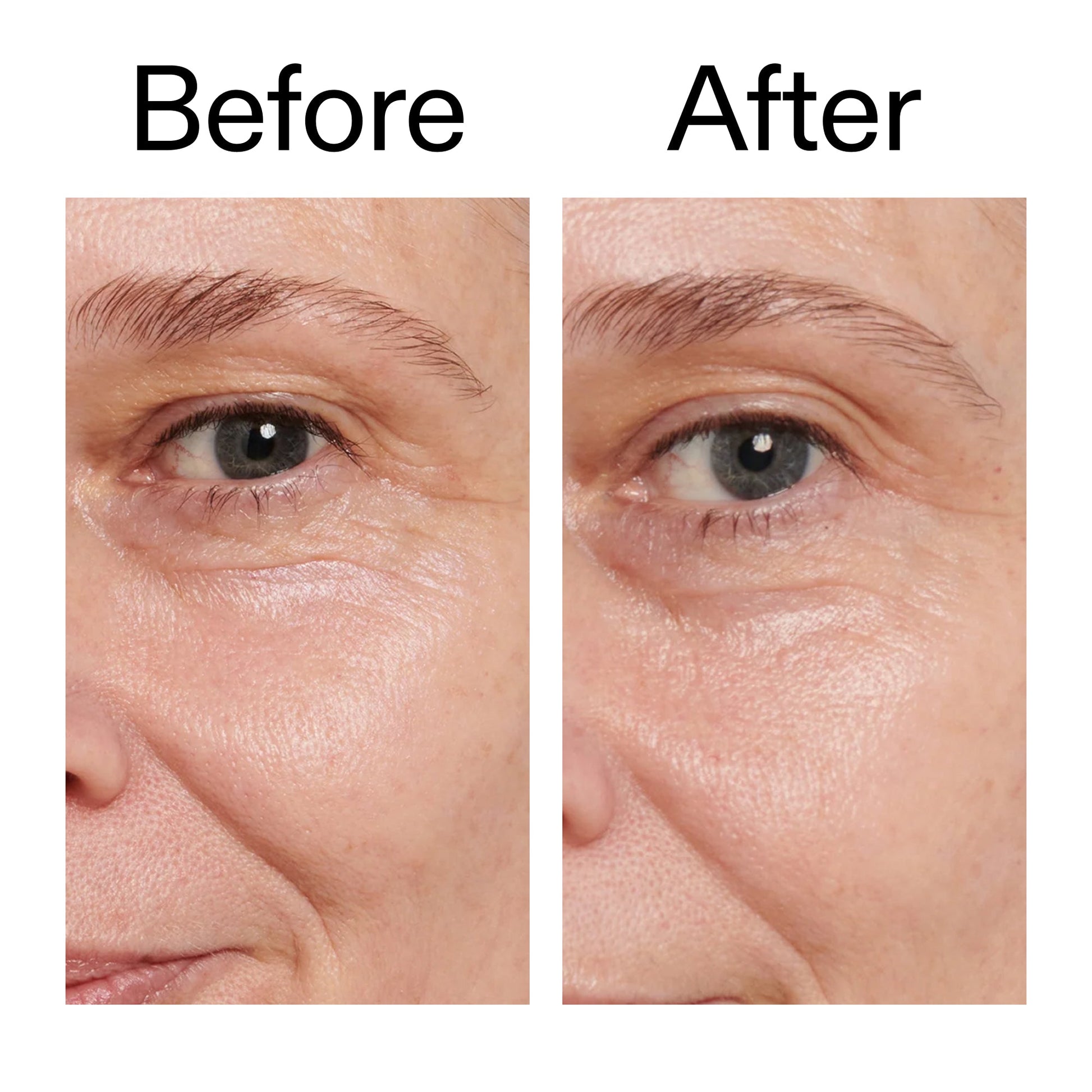 retinol-eye-cream-i7 Retinol_Eye_Cream_Before_After_2000x2000_ac03a80c-109e-4572-a95a-91dc109b4d27.jpg