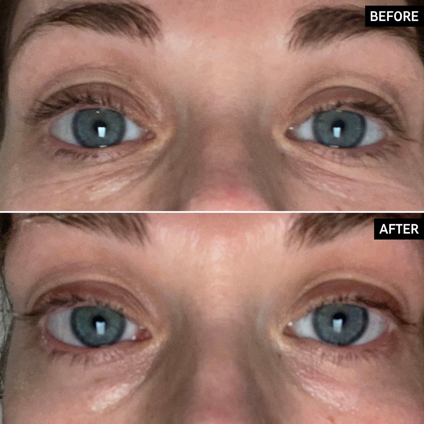 retinol-eye-cream-i7 SITE-UGCBAsApril_Nicole_B_A_PPage_2000x2000_1.jpg