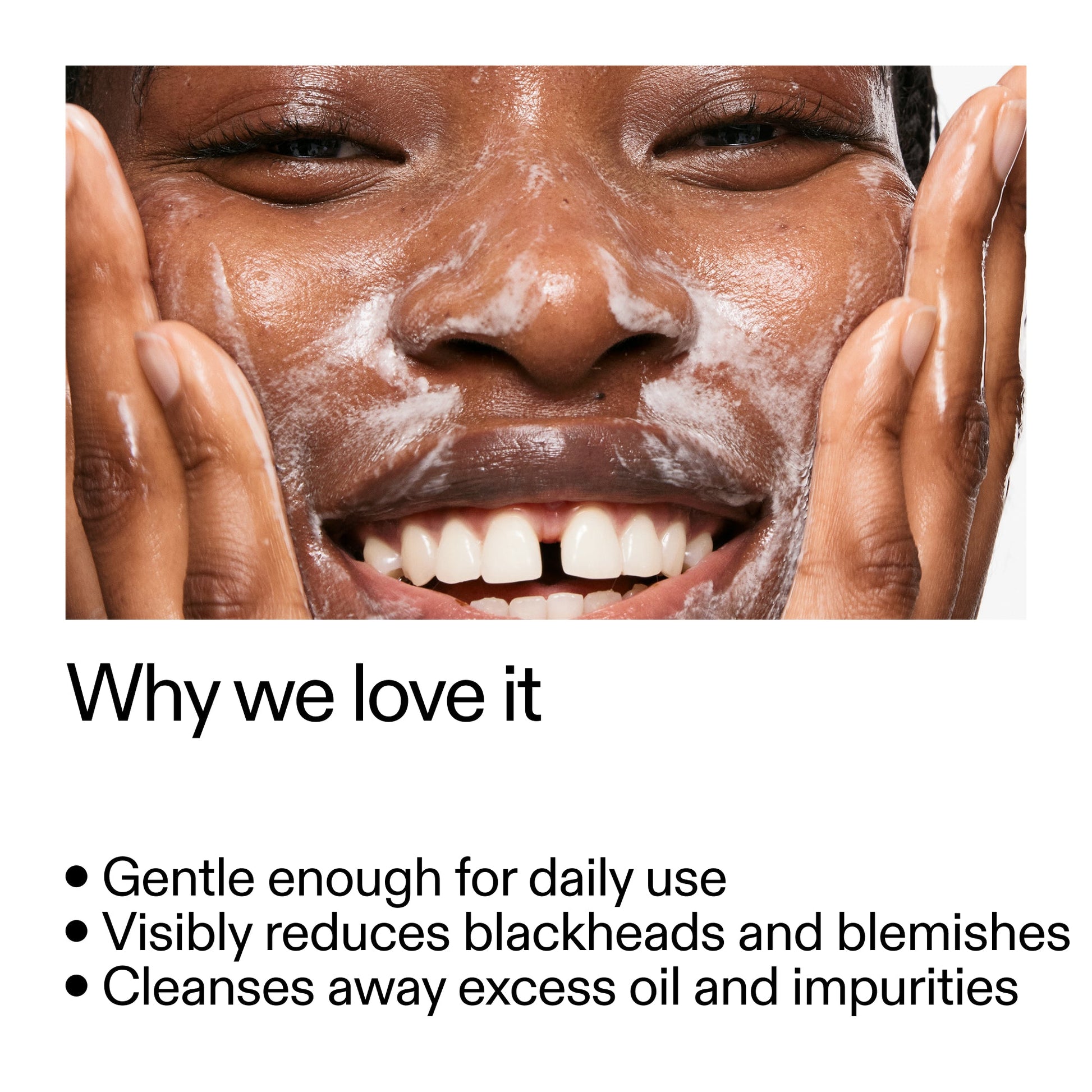 salicylic-acid-cleanser-150ml-h0 Salicylic_Acid_Cleanser_-_300mlWhy_we_love_it_2000x2000_87dc92a9-2559-4309-98cd-4e570f1be735.jpg