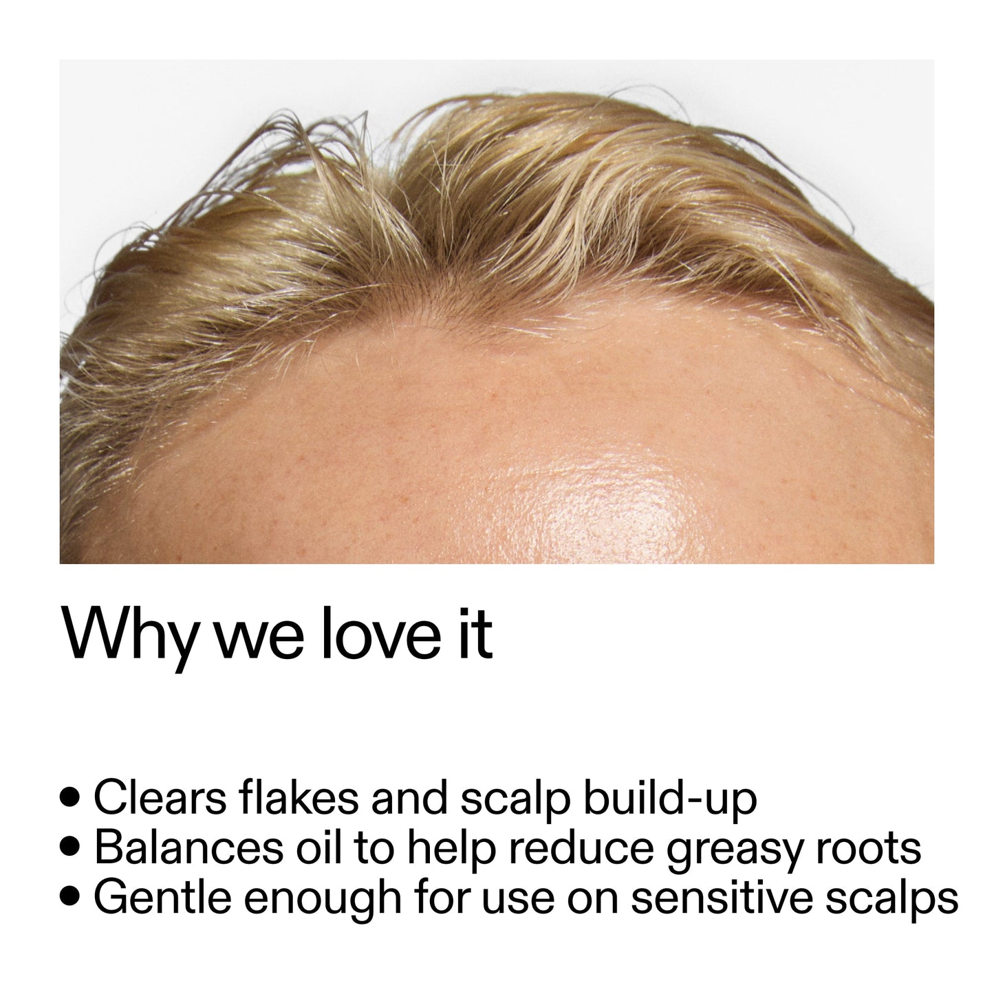 salicylic-acid-exfoliating-scalp-treatment-n2 Salicylic_Acid_Exfoliating_Scalp_Treatment_Why_we_love_it_2000x2000_44b6bd6d-9ec4-4b23-9dc4-bc3fd6f28e14.jpg