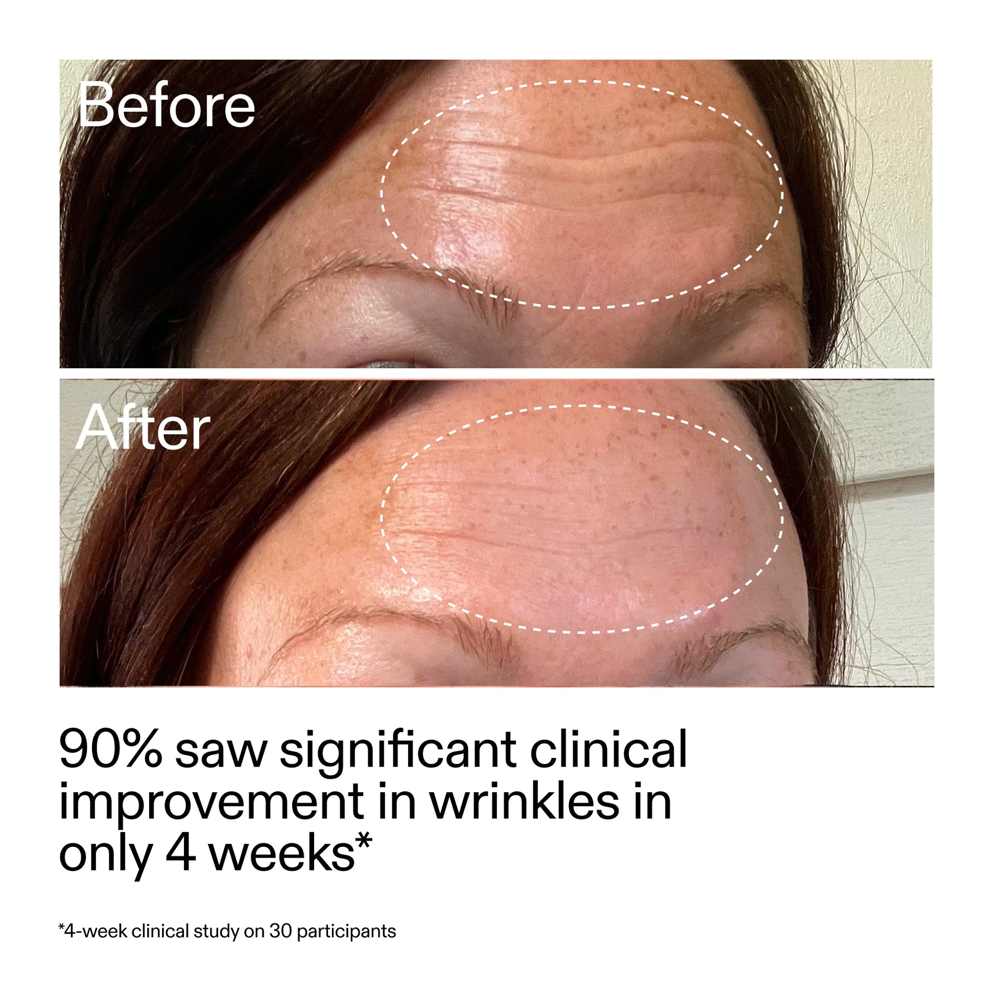 starter-retinol-serum-duo-m0 StarterRetinol_BeforeAfter_Claim1_2000x2000_03b4d6e5-a357-43b9-a855-aba5e35c57f3.jpg