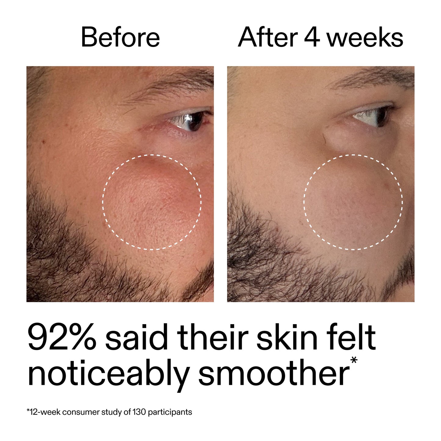 starter-retinol-serum-duo-m0 StarterRetinol_BeforeAfter_Claim3_2000x2000_458243a8-bbb0-4e5d-a274-29c7766d339b.jpg