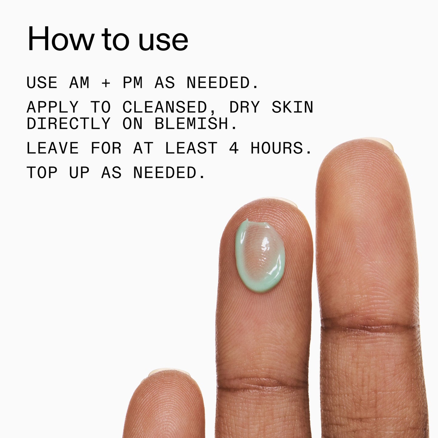 succinic-acid-acne-treatment-u3 Succinic_Acid_Treatment_How_to_Use_2000x2000_d57137d5-d7f1-427c-9a46-5fc00c19c542.jpg