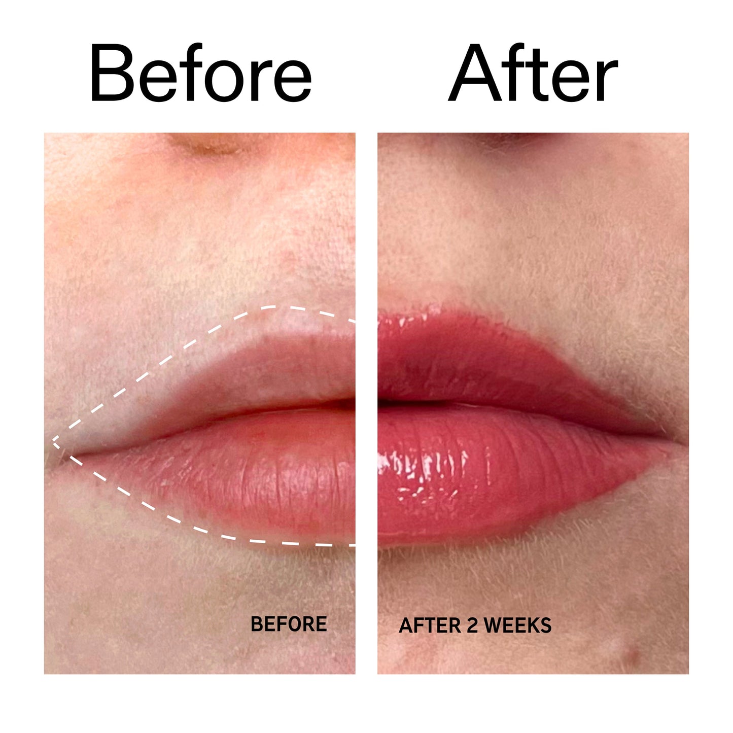 tripeptide-plumping-berry-lip-balm-z6 Tripeptide_Plumping_Lip_Balm_-_Berry_Before_After_2000x2000_9474bbd8-43ca-4b0e-b0e7-dfab70b91927.jpg
