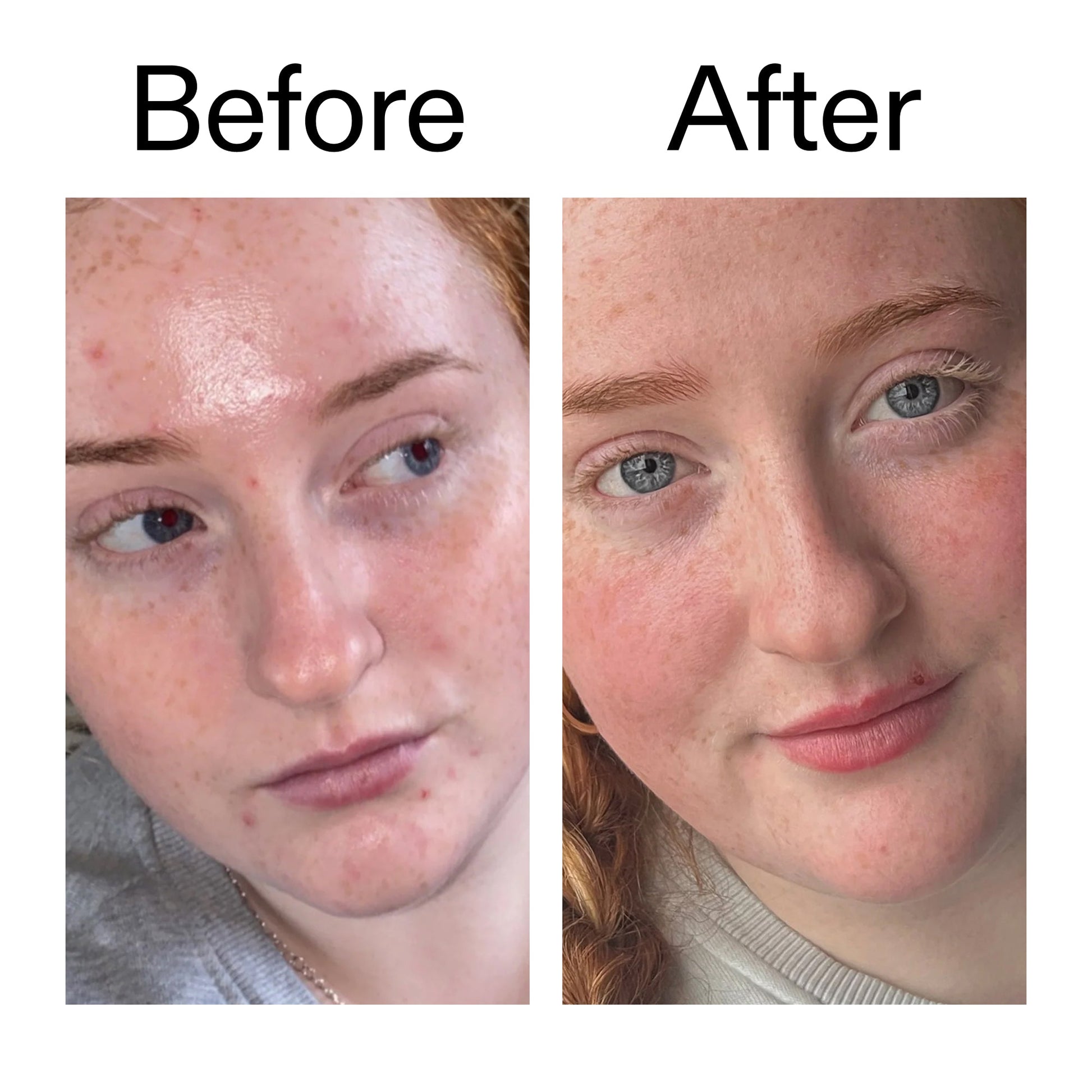 vitamin-b-c-and-e-moisturizer-d2 Vitamin_B_C_and_E_Moisturizer_Before_After_2000x2000_b0781a76-5ad2-4be9-95b8-ef92b356833c.jpg